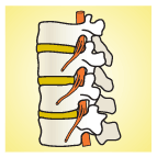 Нормальное состояние позвонков и межпозвоночных дисков